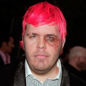 Perez-hilton-black-eye